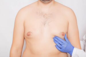 Cosmetic Treatments for Men